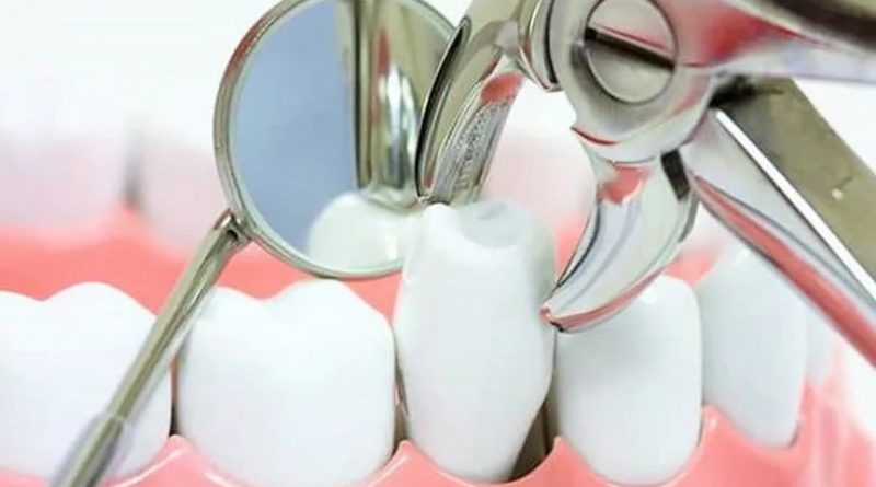 Методики лечения зубов