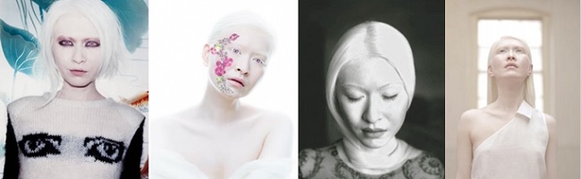 modeli-albinosy