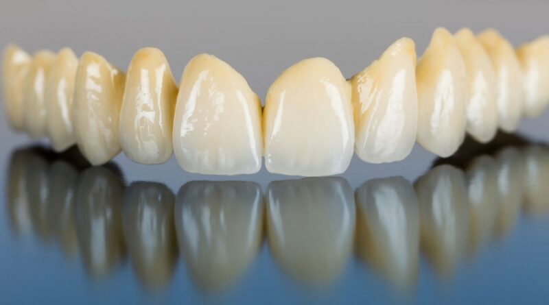 Возможность протезирования зубов с помощью металлической керамики
