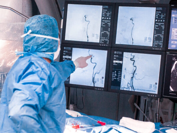 Компьютерная томография и ангиография сосудов